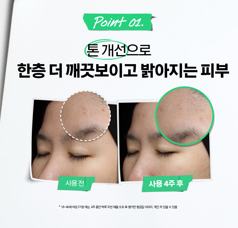 울트라 퓨어 하이-포텐시 세럼 5.0% 나이아신아마이드